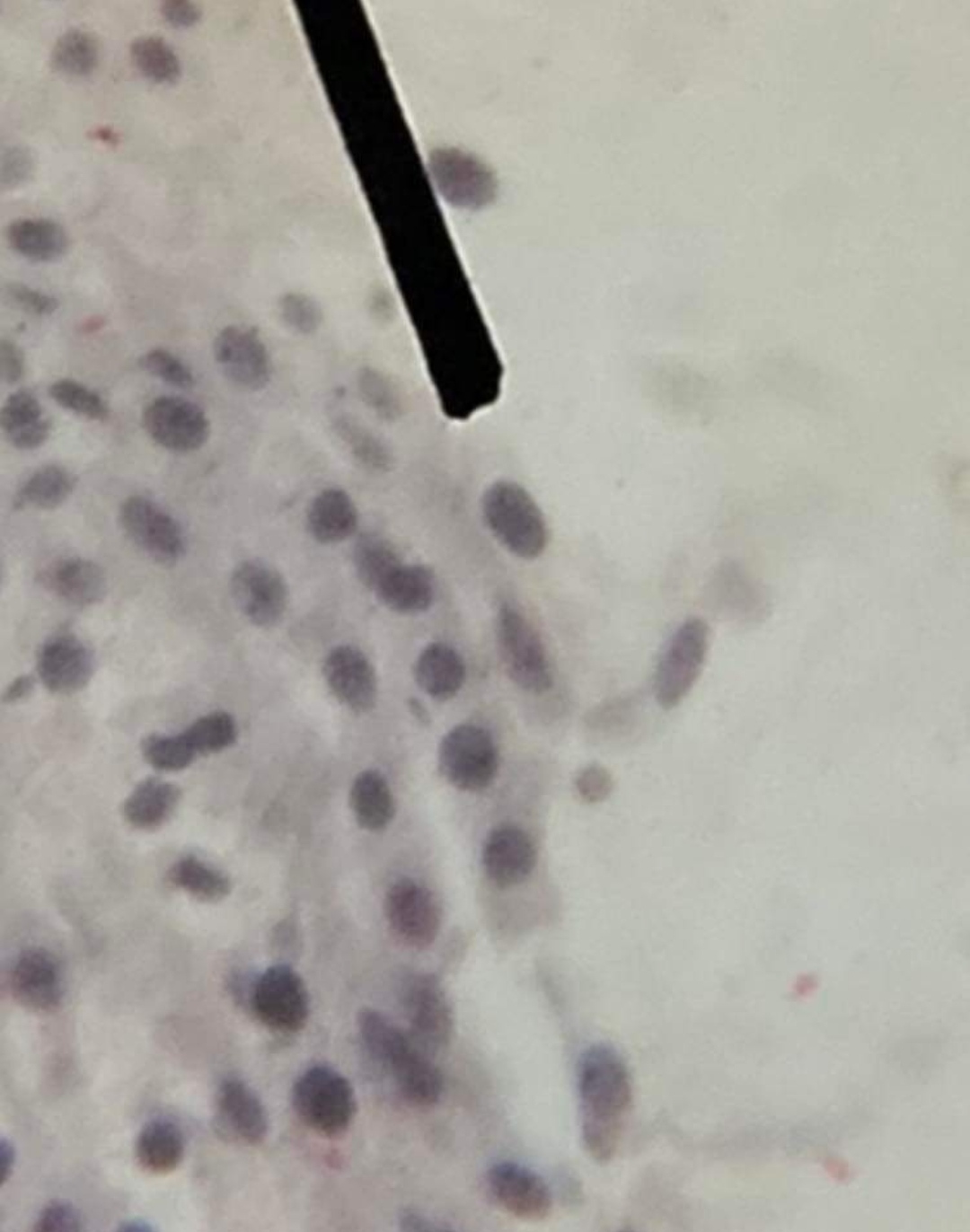 <p>What cell cycle</p>