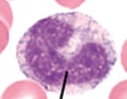 <p>what type of blood cell is this?</p>