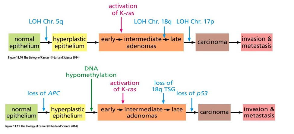 <ul><li><p class="Paragraph WhiteSpaceCollapse SCXP41183249 BCX0" style="text-align: left"><span>Genetic alterations drive phenotypic changes observed histologically (genetic evolution and phenotypic progression)​</span></p></li><li><p class="Paragraph WhiteSpaceCollapse SCXP41183249 BCX0" style="text-align: left"><span>Colon Carcinomas easy to study and high incidence – know most about them​</span></p></li><li><p class="Paragraph WhiteSpaceCollapse SCXP41183249 BCX0" style="text-align: left"><span>q= long arm; p=short arm​</span></p></li><li><p class="Paragraph WhiteSpaceCollapse SCXP41183249 BCX0" style="text-align: left"><span><strong>Fig. 11.11 </strong>​</span></p><ul><li><p class="Paragraph WhiteSpaceCollapse SCXP41183249 BCX0" style="text-align: left"><span>LOH Chr. 5q = loss of APC​</span></p></li><li><p class="Paragraph WhiteSpaceCollapse SCXP41183249 BCX0" style="text-align: left"><span>LOH Chr. 17p = loss of p53​</span></p></li></ul></li></ul><p></p>
