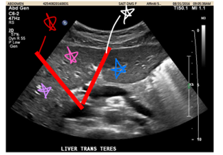 <p>Identify the outlined structures.</p>