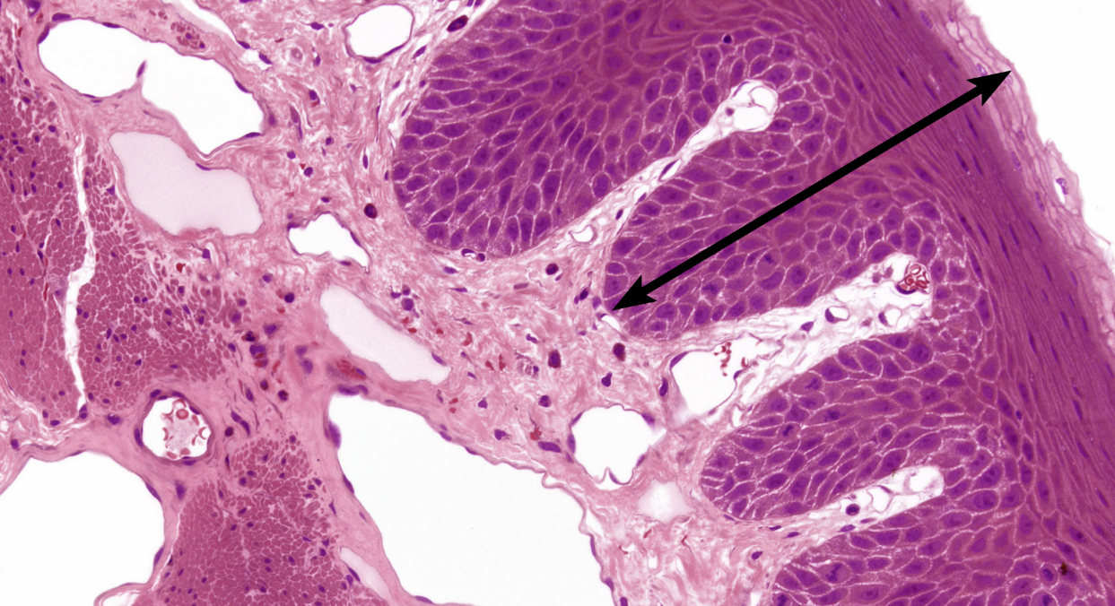 <p>cell type, esophagus</p>
