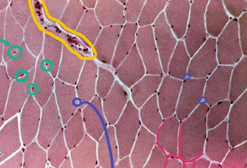 <p>What is the pink likely representing?</p>