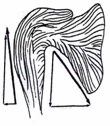 <p>In the example shown at right the deltoid and oblique rotator cuff muscles function as a force couple to abduct the shoulder joint. What is the importance of the offsetting vertical force components? </p><p>a. They push the humeral head against the acromion. </p><p>b. They prevent excessive anterior/posterior translation of the humeral head. </p><p>c. They stabilize the humeral head on the glenoid. </p><p>d. They limit the amount of internal rotation that accompanies abduction.</p>