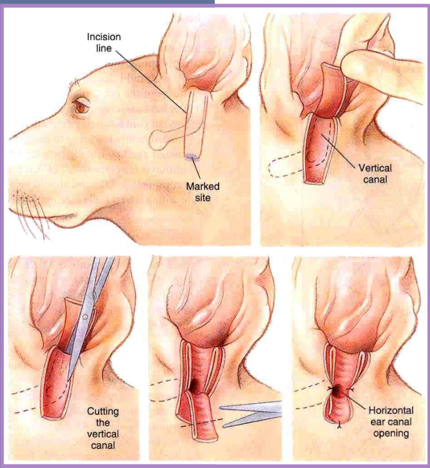 <ul><li><p>removes the lateral wall of the vertical ear canal </p></li><li><p>new opening is at junction of vertical and horizontal canal </p></li><li><p>indications </p><ul><li><p>adjunct to medical management for otitis externa </p></li><li><p>minimal hyperplasia of ear canal </p></li><li><p>small neoplastic lesions of lateral aspect of vertical canal </p></li></ul></li><li><p>allows for increased drainage, aeration of canal, facilitates medication administration </p></li><li><p>owner beware - must still medicate the ear </p></li><li><p>not for concurrent otitis media or obstruction of the horizontal ear canal </p></li></ul><p></p>