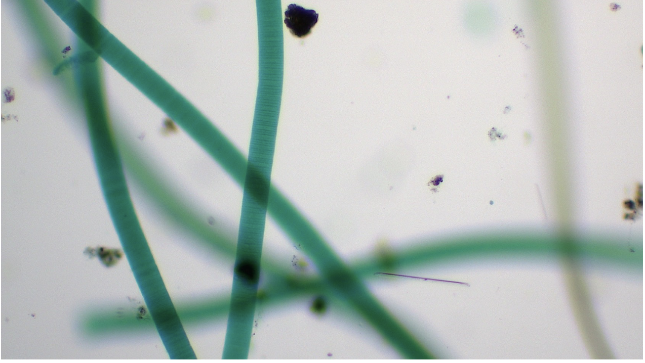 <p>Domain: Bacteria</p><p>Phylum: Cyanobacteria</p><p>Shape: filament/bacillus</p><p>Movement: oscillating/whip-like motion</p><p>Metabolic: Autotrophic</p>
