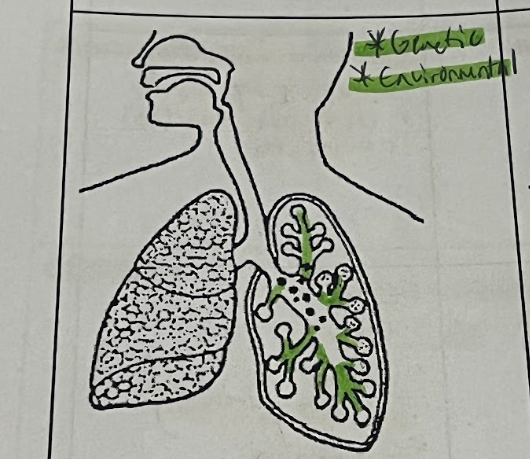 <p>Bronchioles</p>