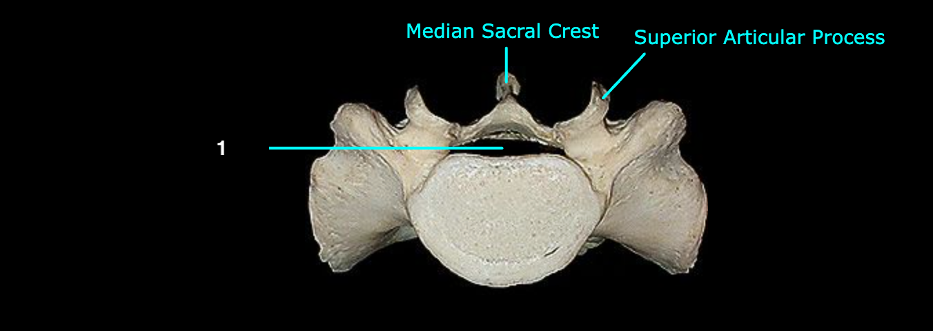 <p>What structure is labeled 1?</p>