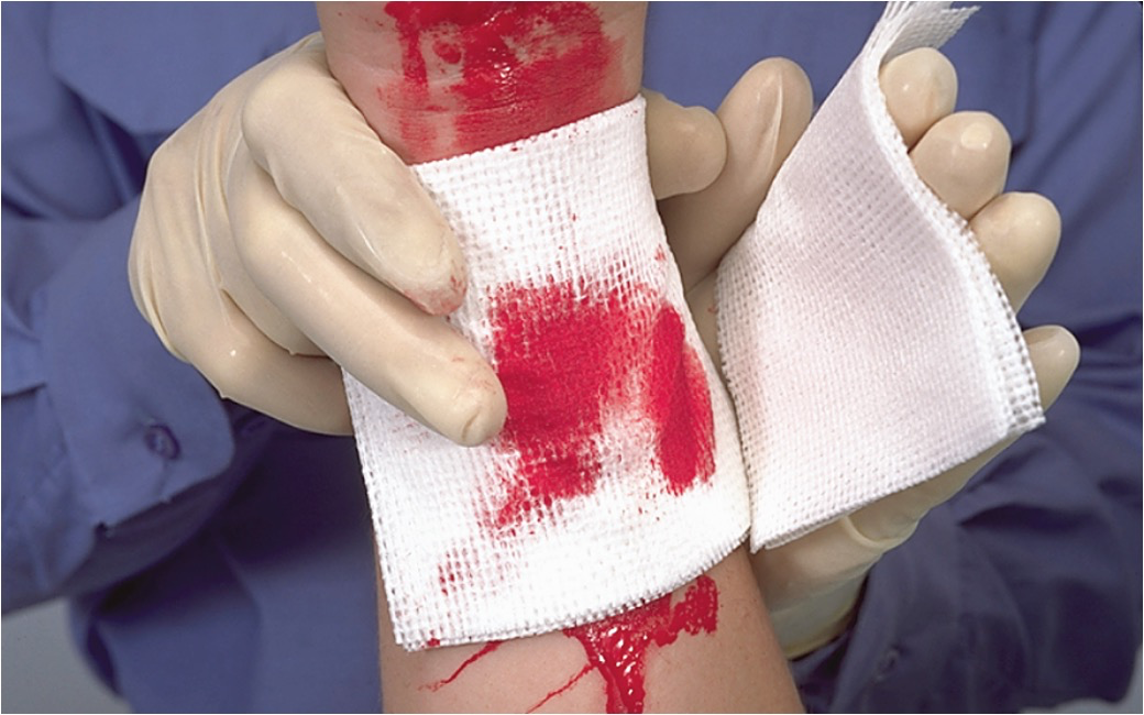 <p><span><span>Dressings cover wounds.</span></span></p>