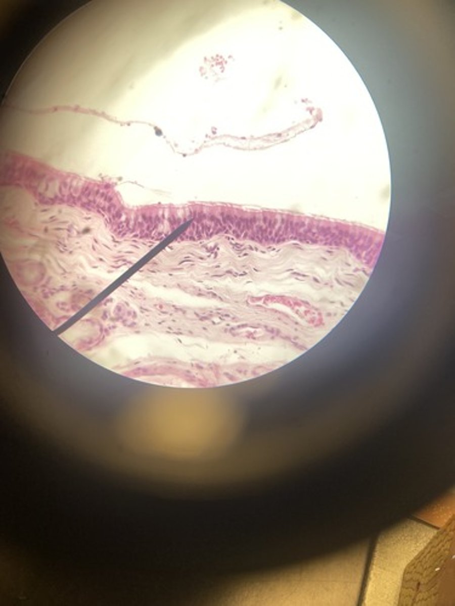 <p>What type of epithelium</p>