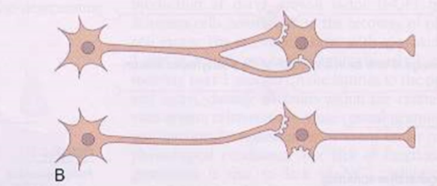 <p>- process of axonal shearing</p><p>- more receptors on one axon compared to another</p><p>- receptor sites upregulate in response to shearing in order to maintain the same level of excitability</p>