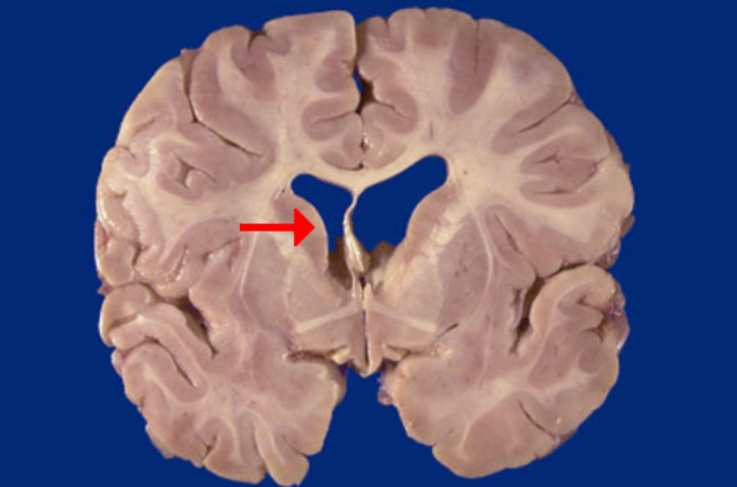 <p>Label this brain structure</p>