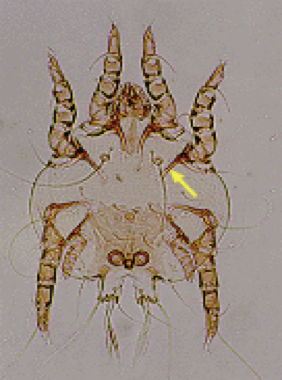 <p>what kind of mite</p>