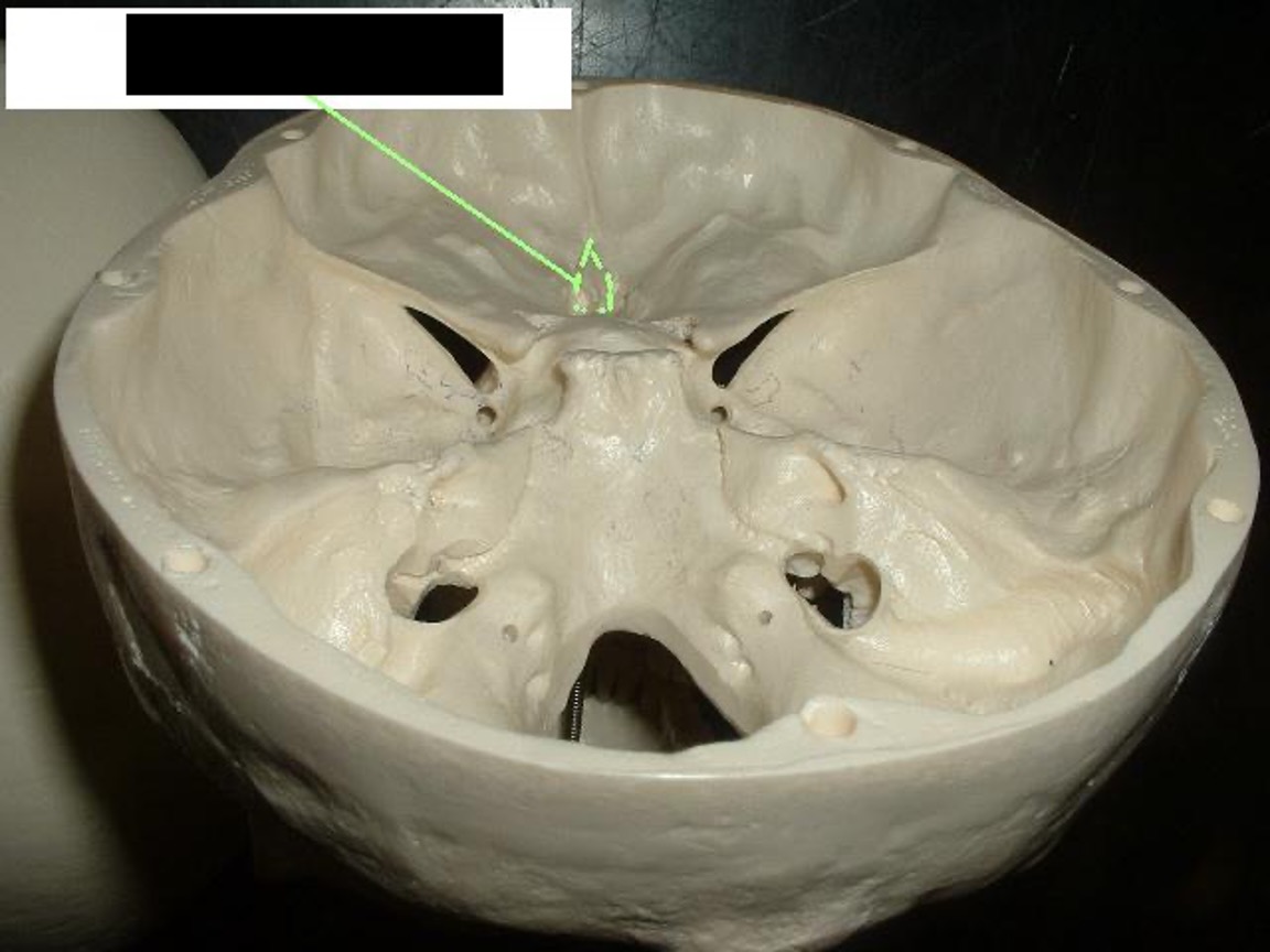 <p>The sharp part in front of the “bat” sticks up in between the Cribiform Plate.</p>