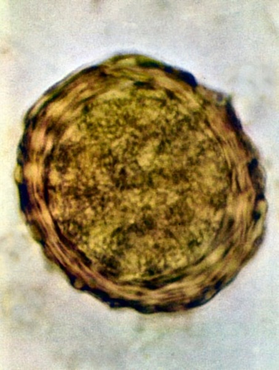 <p>PHASMID nematodes; GOLDEN BROWN mamiliated egg; MOST COMMON helminth worlwide can migreate from lung to heart</p><p>MOT: ingestion of EMBRYONATED egg</p>