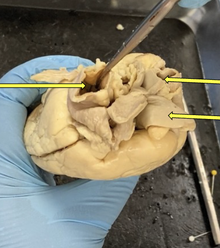 <p>what view of the heart is this?<br>label from top to bottom&nbsp;</p>