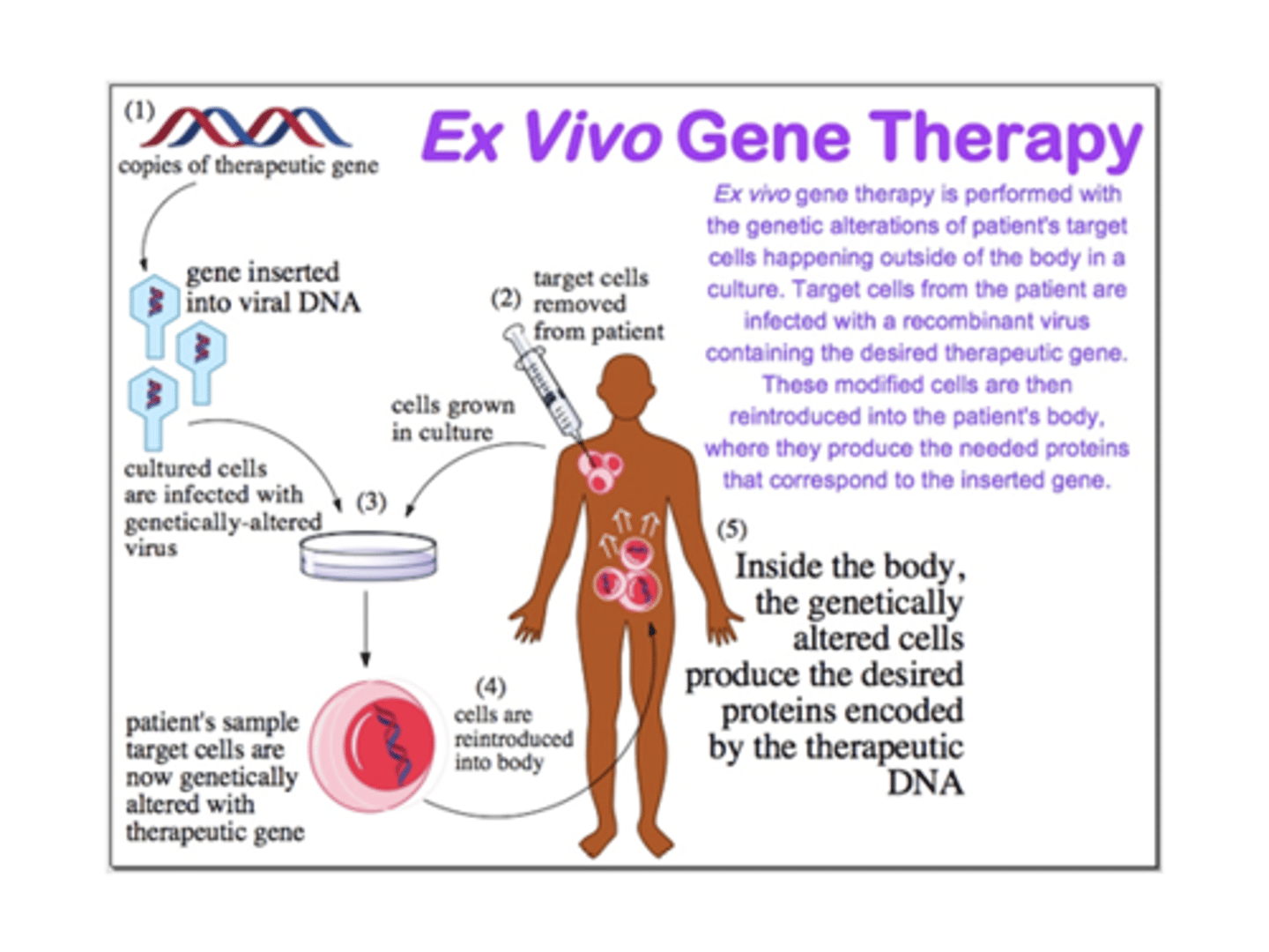 <p>applied to cells outside of body that are then returned via IV infusion or into spinal fluid</p>
