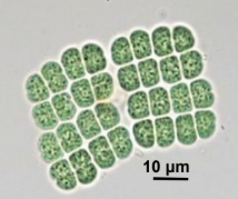 <p>freshwater plankton; considered benign</p>