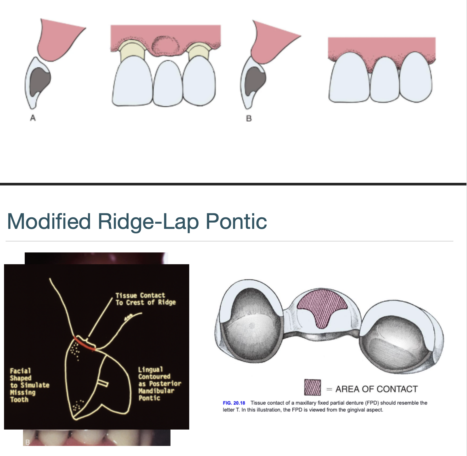 <p>esthetics w easy cleaning </p>