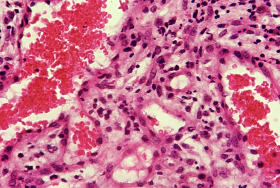 <p>Células hemáticas</p>