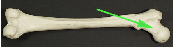 <p>Name the part of the femur indicated by the green arrow.</p>