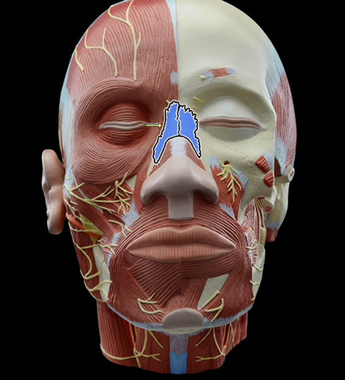 <p>Nasal bone</p>