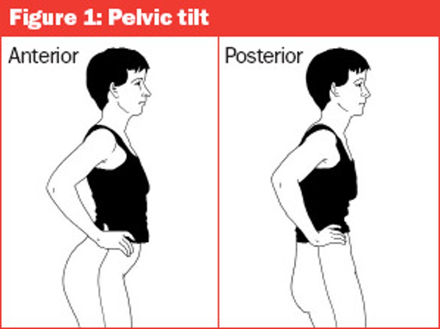 <p>one side of the pelvis is forward of the other side</p>