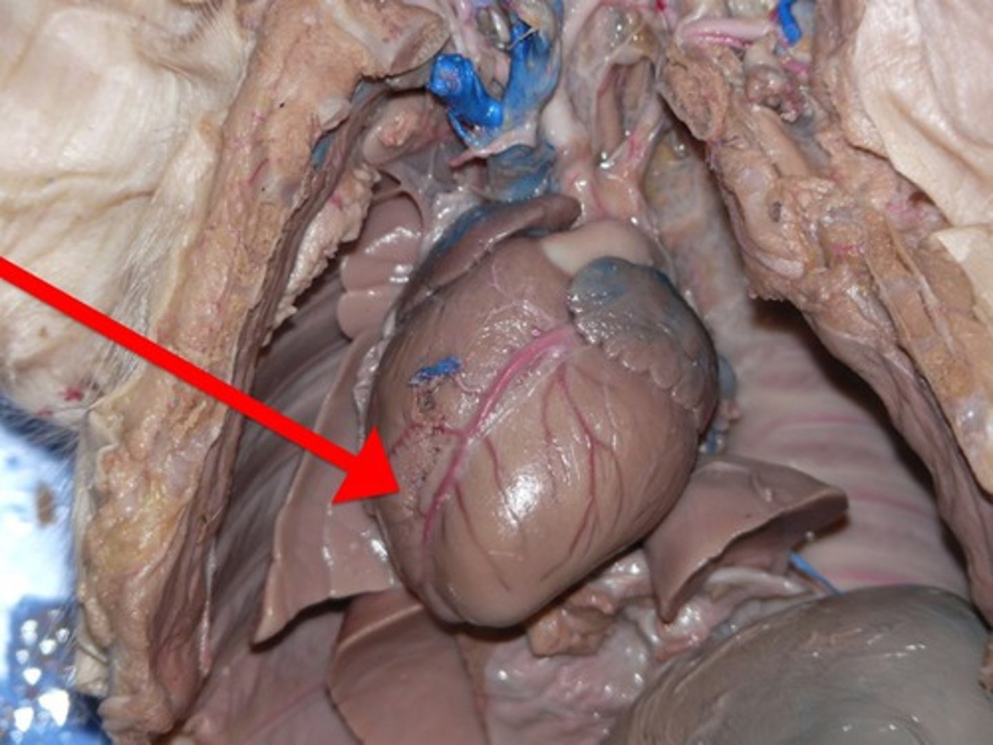 <p>The chamber of the heart that receives venous blood from the right atrium and pumps it into the pulmonary artery.</p>