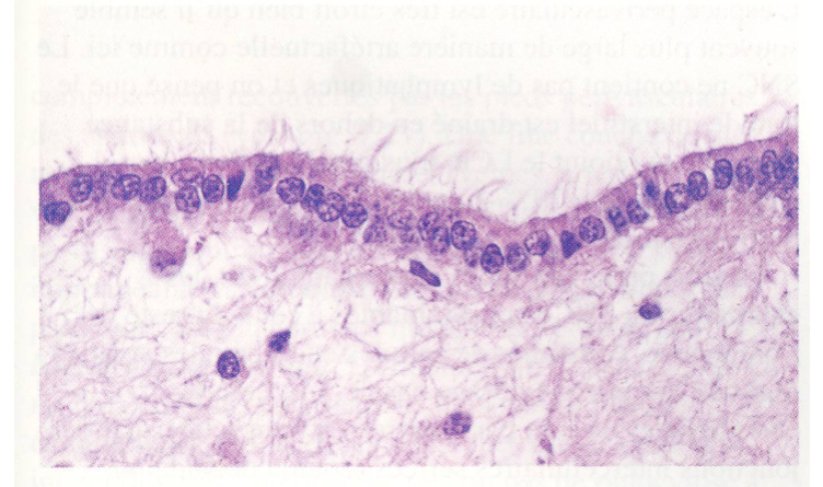 <p>cellules cubiques/cylindriques, cilié, pas vraiement une memb basale. </p><p>reposent directement sur des astrocytes plutôt qu’une memb basale donc communication plus efficace. </p>