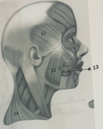 <p>What muscle is 13?</p>