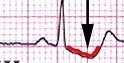 the time during which ventricles are contracting and emptying