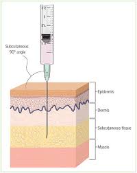 <p>Subcutaneous</p>