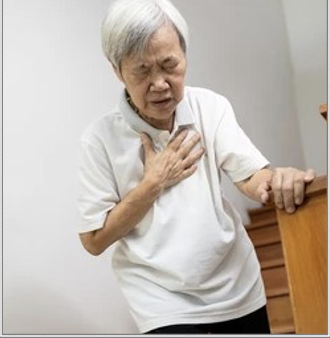 <p><strong>Signs:</strong></p><ul><li><p class="">Irregular pulse</p></li><li><p class="">"Pulse deficit"</p></li><li><p class="">Variable heart sounds</p></li><li><p class="">May present with a murmur or pulmonary edema</p></li></ul><p class=""><strong>Symptoms:</strong></p><ul><li><p class="">Palpitations</p></li><li><p class="">Shortness of breath</p></li><li><p class="">Dizziness/lightheadedness</p></li><li><p class="">Chest pain</p></li><li><p class="">Fatigue</p></li><li><p class="">Dyspnea on exertion</p></li></ul><p class=""><strong>Important to Know:</strong></p><ul><li><p class="">May be asymptomatic</p></li><li><p class="">Patients are 5 times more likely to suffer a <strong>stroke</strong> (approximately 15% are caused by A-fib)!!</p></li></ul><p></p>