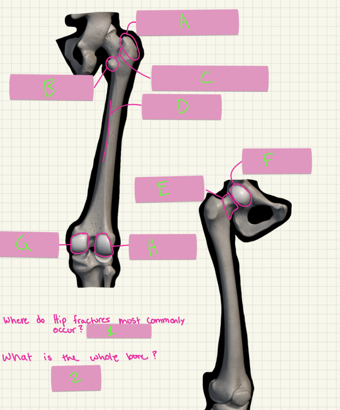 <p>What’s E-H?</p>