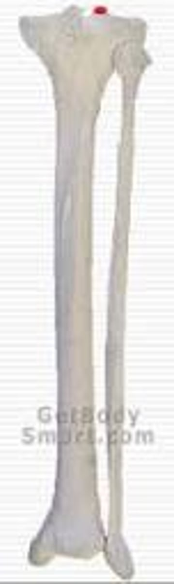 <p>forms the lateral part of the INTERCONDYLAR EMINENCE</p>