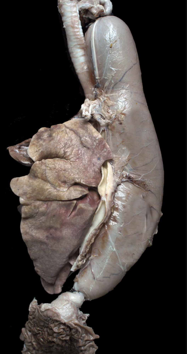 <ol><li><p>Idiopathic </p></li><li><p>Muscle Disease</p><ol><li><p>Myasthenia Gravis</p></li><li><p>Hypoadrenocortisism</p></li><li><p>Hypothyroidism</p></li><li><p>Esophagitis</p></li></ol></li></ol><p></p>