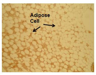 <p>connective tissue</p><p>structure: spherical or round, 95% fats, nucleus pushed to one side, highly vascular</p><p>location: under skin, around kidneys, eyeballs, other organs</p><p>function: cushioning, insulation, energy storage</p>