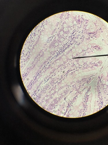 What is the organ?