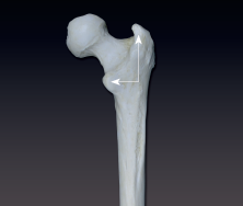 <p>a large process only found on the femur</p>