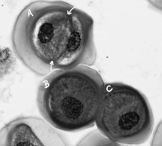 <p>what stage of cell division is this?&nbsp;</p>