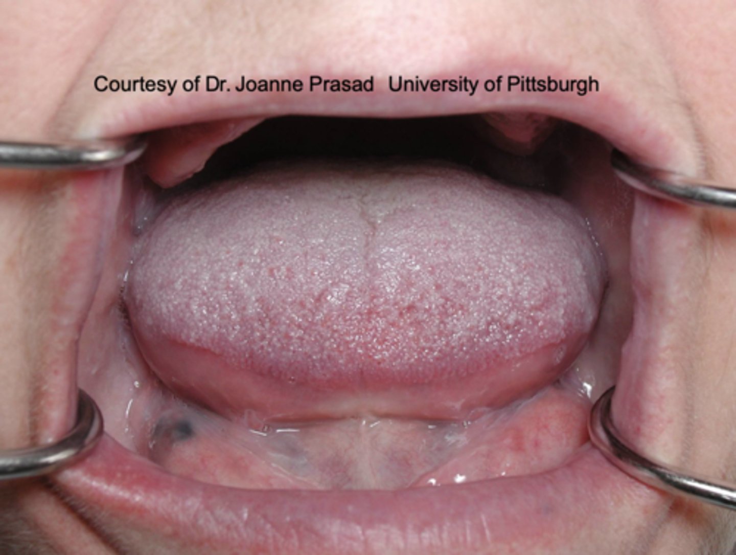<p>What type of pigmented lesion?</p>