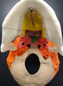 <p>What is the bone (brown region)?</p>