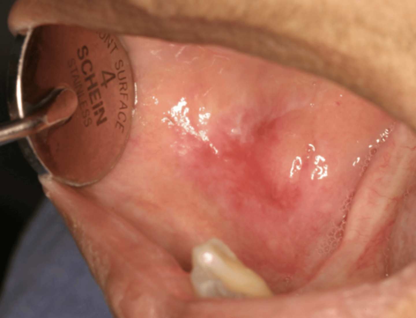 <p>What condition?</p>