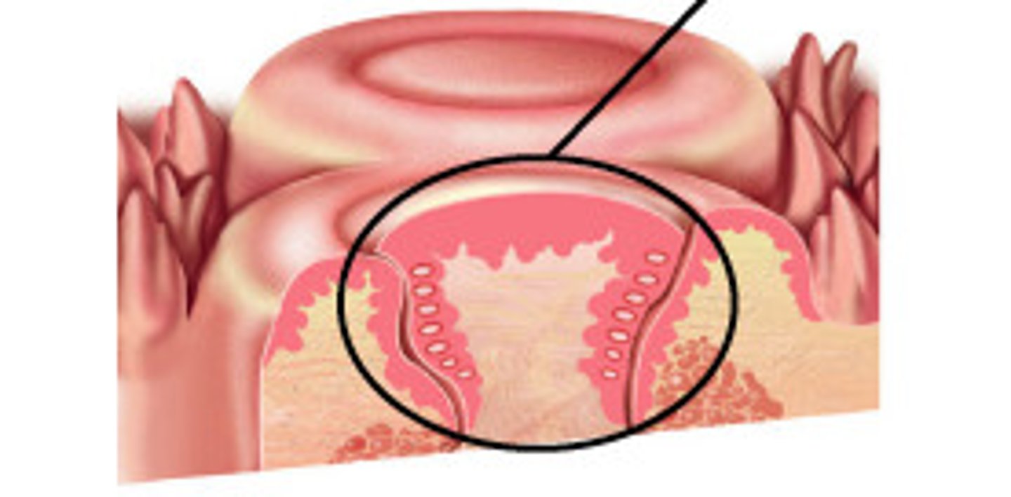 knowt flashcard image