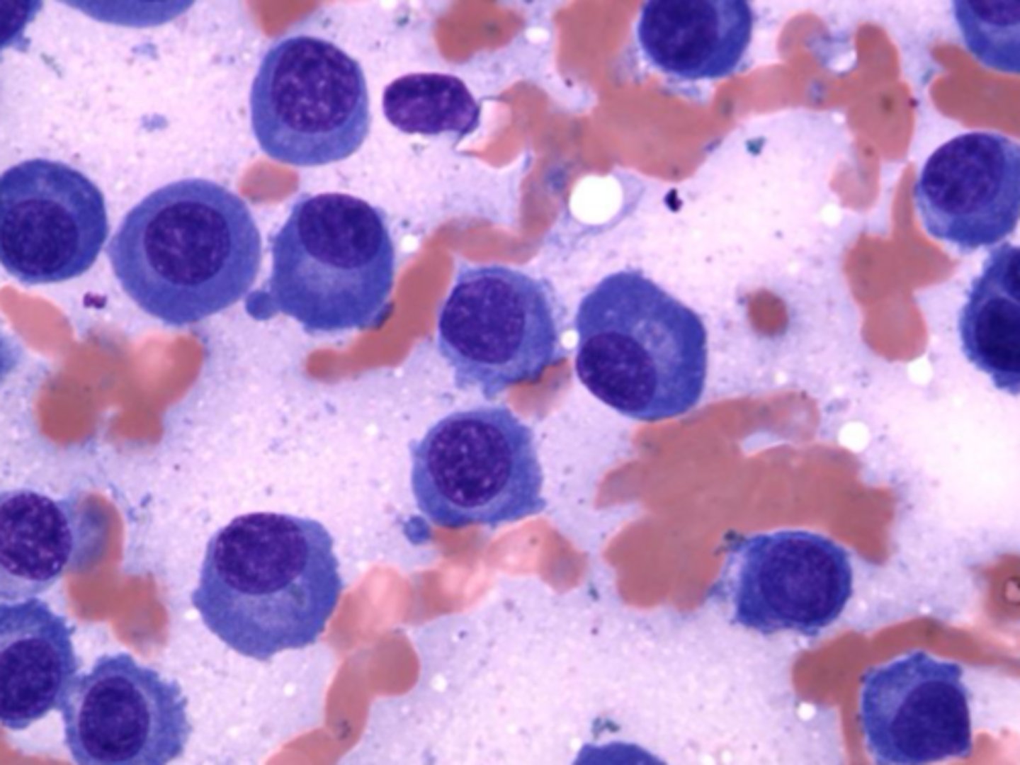 <p>Identify the type of round cell neoplasia?</p>