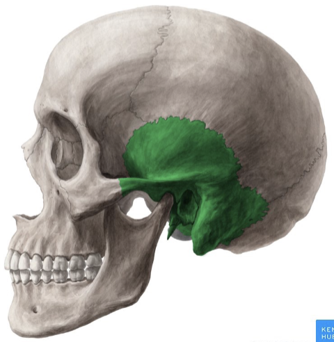 term image