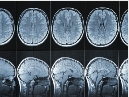 uses magnetic and radio fields to take detailed two-dimensional and three-dimensional images of the brain.