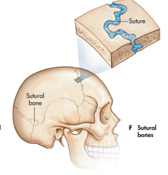 <p>between the flat bones of the skull</p>