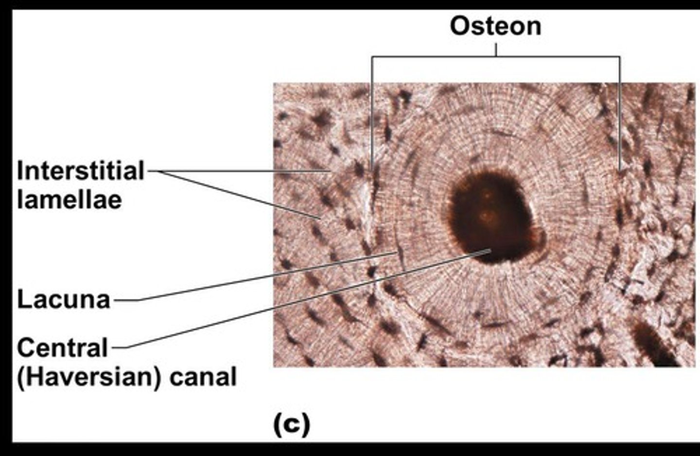 <p>Opening in the center of an osteon that runs lengthwise through bone and carries blood vessels and nerves.</p>
