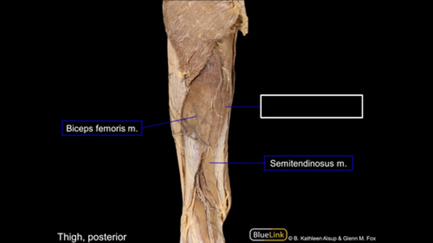 <p>Origin: Ischial tuberosity</p><p>Insertion: Tibia medial condyle</p>