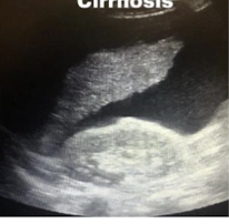 <p>What is this and what type of scan </p>